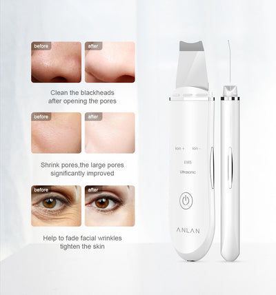 Brosses et systèmes de nettoyage pour les soins de la peau